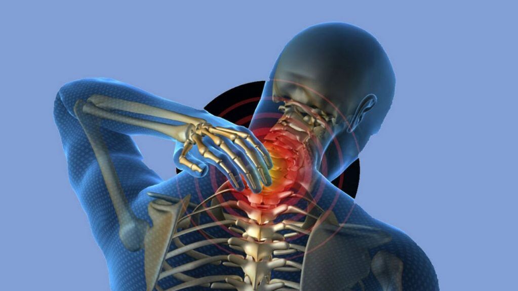 Osteochondrosis of the cervical region